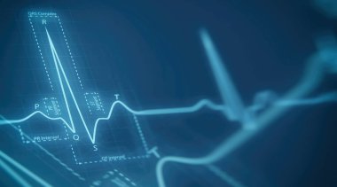 eart beats cardiogram
