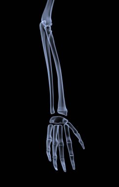 Bir insanın elinin X-ray 'i (3 boyutlu görüntüleme))