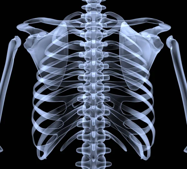 Chest Ray Rendering — Stock Photo, Image