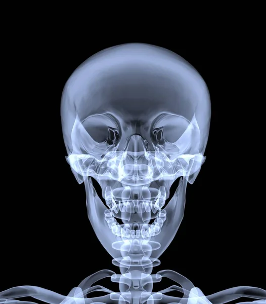 Röntgenbild Des Menschlichen Schädels Frontansicht Darstellung — Stockfoto