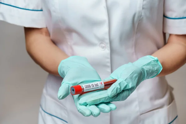 Médico enfermeira mulher usando máscara protetora e luvas - segurando teste de sangue vírus — Fotografia de Stock