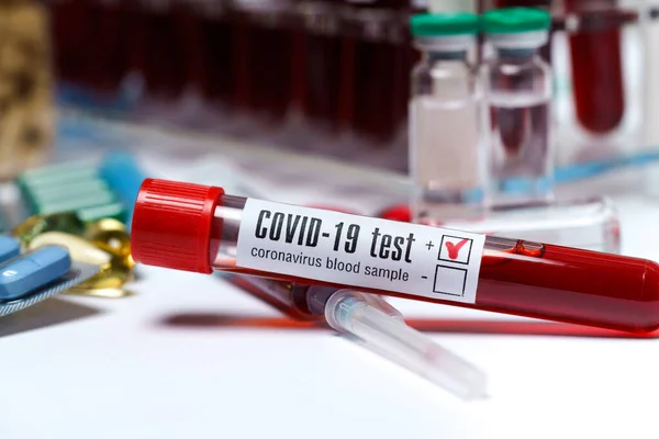 Provette per analisi del sangue e imballaggi di pillole e capsule di medicina — Foto Stock