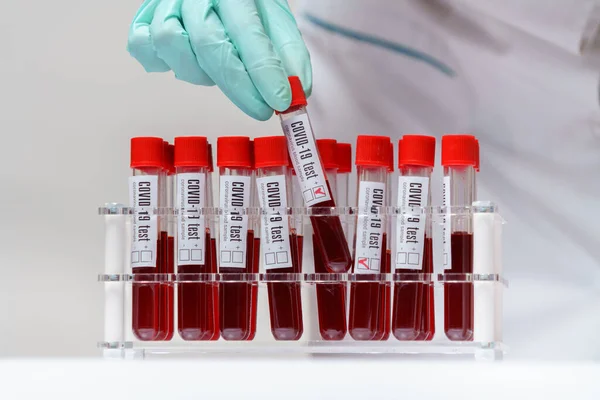 Medische arts verpleegkundige vrouw werken met virus bloedonderzoek rack — Stockfoto