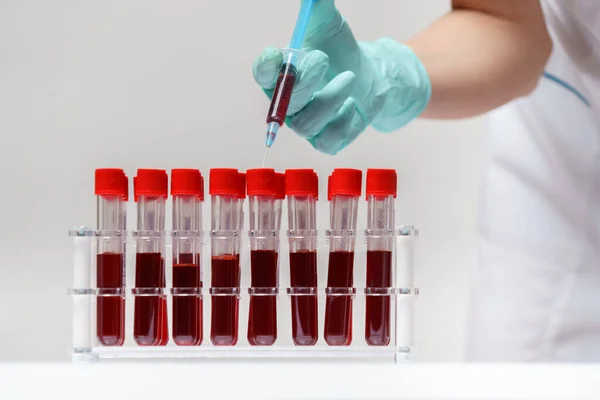 Medische arts verpleegkundige vrouw werken met virus bloedonderzoek rack — Stockfoto