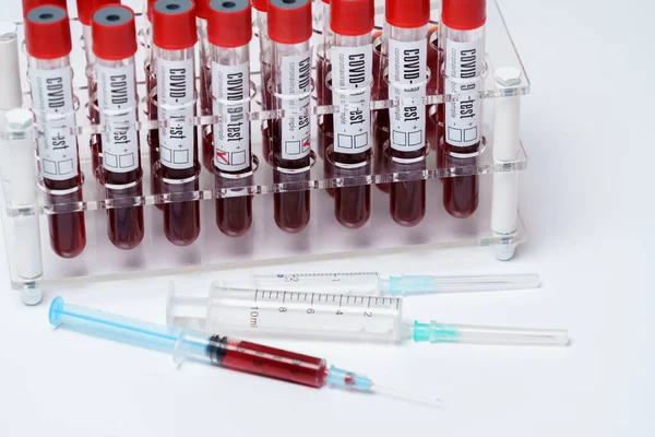 Aantal bloedbuisjes voor het testen van biologisch materiaal — Stockfoto