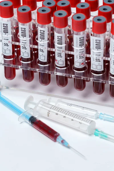 Rack of Tubes of blood sample for testing biological material — 图库照片