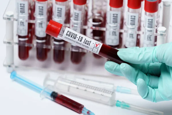 Rack de tubos de amostra de sangue para testar material biológico — Fotografia de Stock