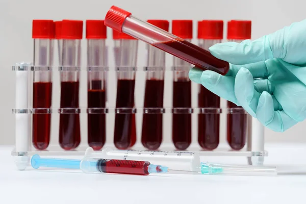 Rack of Tubes of blood sample for testing biological material — 图库照片