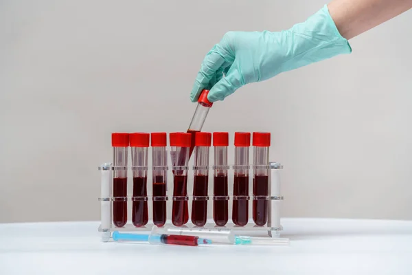 Aantal bloedbuisjes voor het testen van biologisch materiaal — Stockfoto