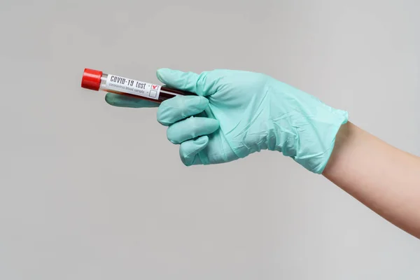 Orvos nővér nő visel latex kesztyű - gazdaság vírus vérvizsgálat — Stock Fotó