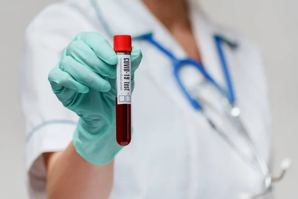 Médico enfermeira mulher usando máscara protetora e luvas - segurando vírus tubo de teste de sangue — Fotografia de Stock