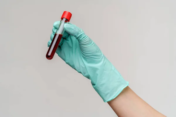 Hand in hand latex handschoen met bloed in reageerbuis close-up — Stockfoto
