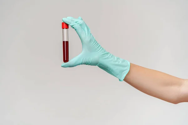 Mão em luva de látex segurando sangue em tubo de teste de perto — Fotografia de Stock