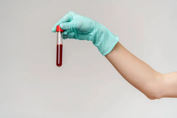 Mão em luva de látex segurando sangue em tubo de teste de perto — Fotografia de Stock