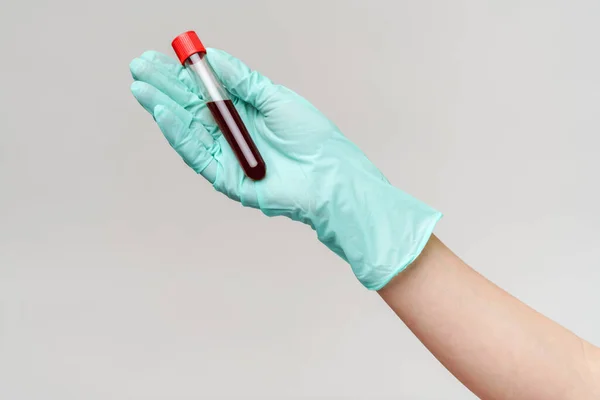 Mão em luva de látex segurando sangue em tubo de teste de perto — Fotografia de Stock