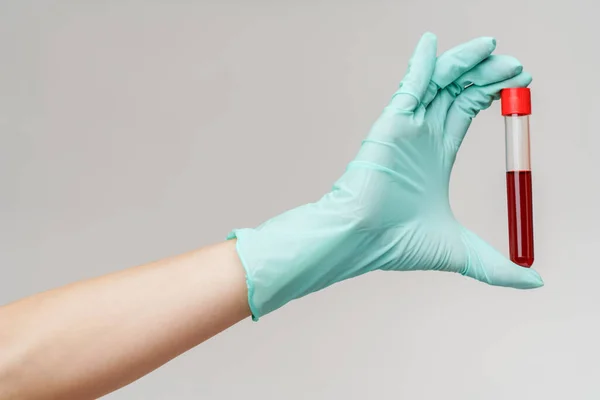 Mão em luva de látex segurando sangue em tubo de teste de perto — Fotografia de Stock