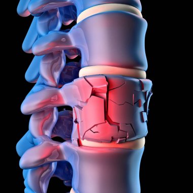 insan spinal kemik 3d