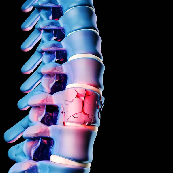 Hueso espinal humano 3d — Foto de Stock
