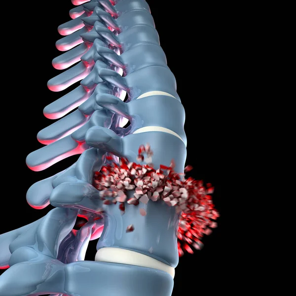 Menselijke spinal bone 3d — Stockfoto