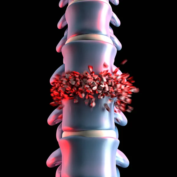 Insan spinal kemik 3d — Stok fotoğraf