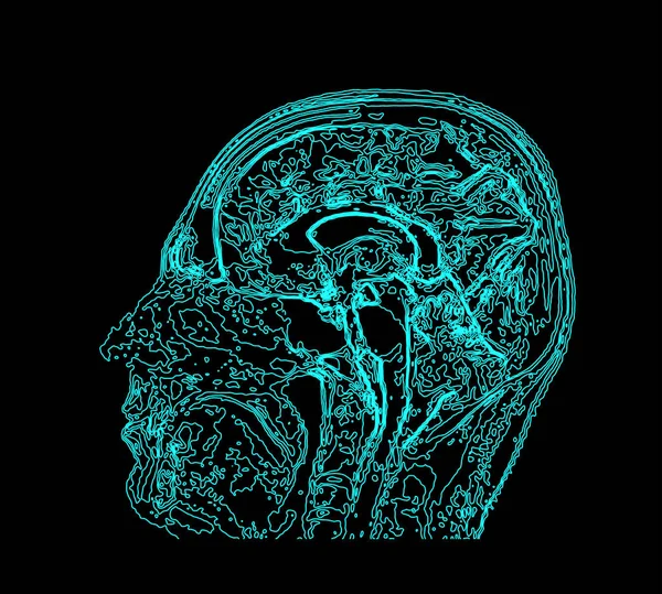 Mappa topografica RM del cervello umano . — Vettoriale Stock