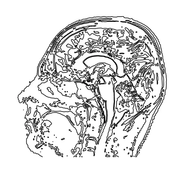 Topographic map MRI of the human brain. — Stock Vector