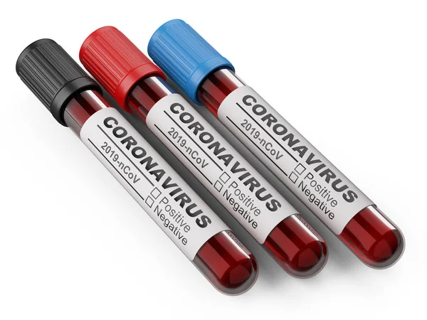 Envases Médicos Con Sangre Para Prueba Enfermedad Viral Del Coronavirus — Foto de Stock