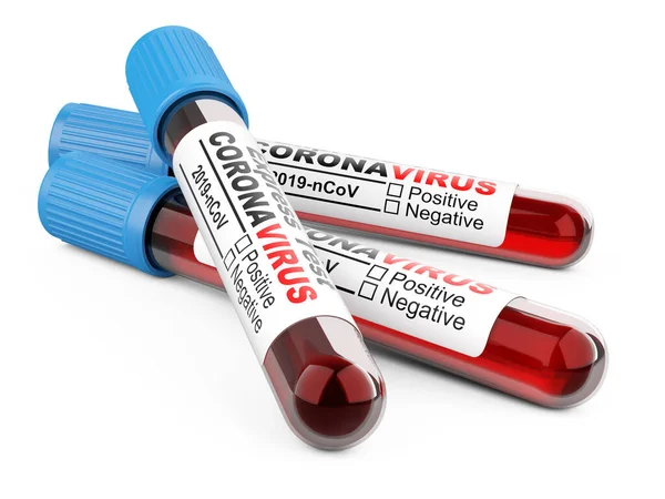Tři Zkumavky Krevními Vzorky Pro Coronavirus Test Covid Koncepce Ochrany — Stock fotografie