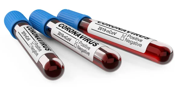 Tres Tubos Con Muestras Sangre Para Prueba Del Coronavirus Covid — Foto de Stock