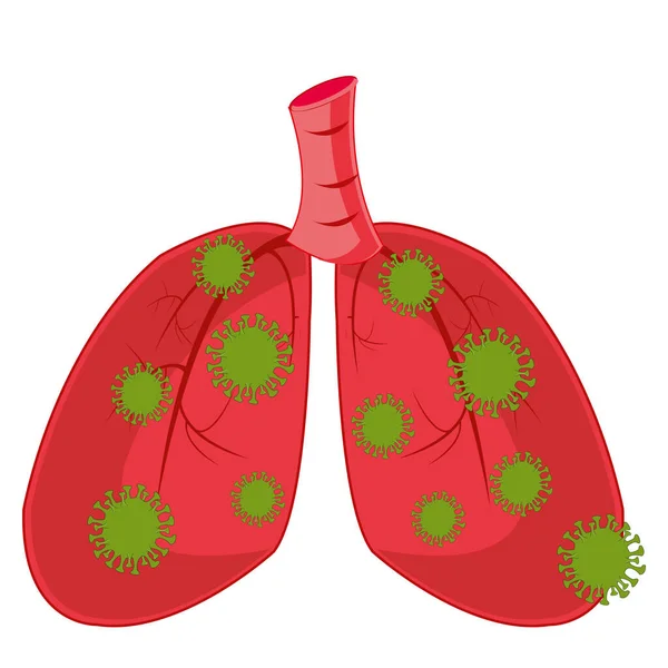 A személy belső szervei fény által okozott fertőzés coronavirus — Stock Vector