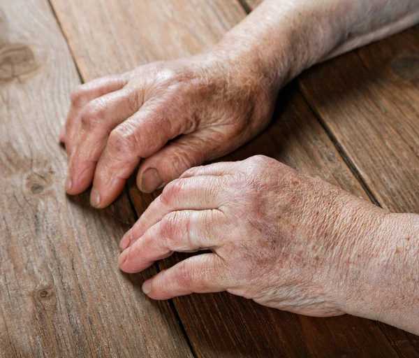 Mani di una donna anziana primo piano su un tavolo — Foto Stock