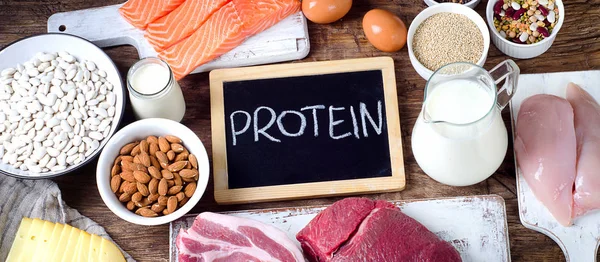 Svarta tavlan med Protein text — Stockfoto