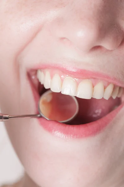Diş kontrol — Stok fotoğraf
