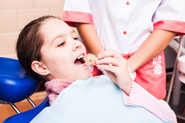치아 치아 교정의 방법 — 스톡 사진