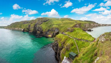 Carrick-a-Rede, Causeway sahil