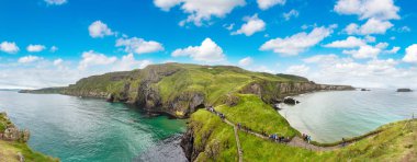 Carrick-a-Rede, Causeway sahil