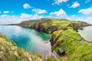 Carrick-a-Rede, Causeway sahil