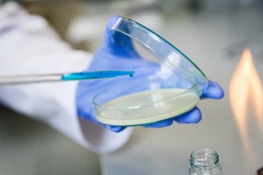 Laboratuvar asistanı tıbbi equ kullanarak bakteri örneğini analiz eder.