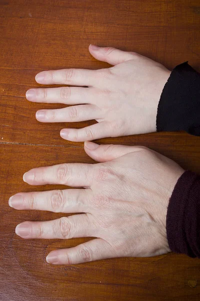 Hands of two women — Stock Photo, Image