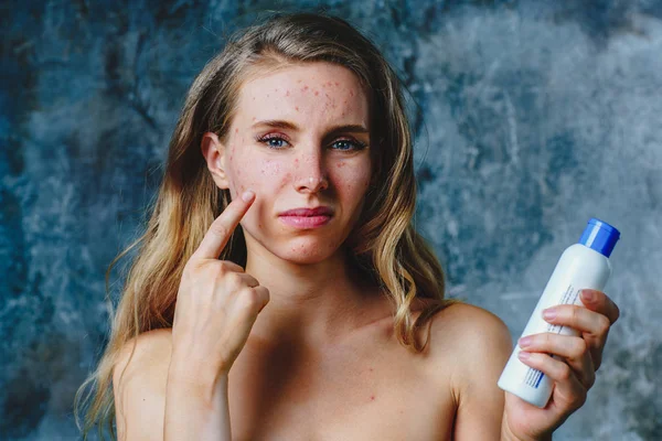 Allergy on face cream — Stock Photo, Image