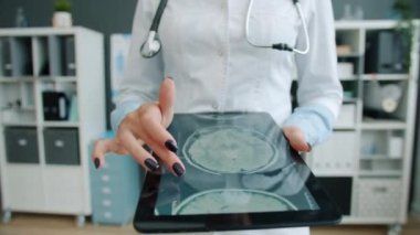 Kadın doktorların ellerinin tablet ekrana dokunup hastanın MR sonuçlarını kontrol ettiği yakın plan.