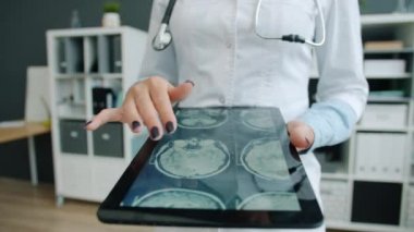 Kadınların ellerinin MRI görüntüleriyle tablet ekranlara dokunduğu yakın plan, ofiste çalışan doktor