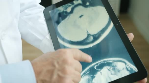 Primer plano de los médicos que tocan la pantalla de la tableta con los resultados de resonancia magnética del paciente — Vídeos de Stock