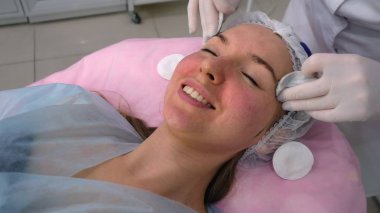 Karbon yüz soyma işlemi.