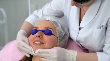 Karbon yüz soyma işlemi.