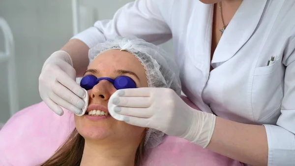 Koolstof gezicht peeling procedure. — Stockfoto