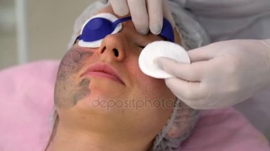 Karbon yüz soyma prosedürü. Lazer darbeleri yüz derisini temizler. Donanım kozmetoloji tedavisi. Fototermoliz süreci, deriyi ısıtma, lazer karbon soyma. Yüz yenileme..