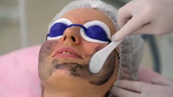 Carbon Face Peeling Verfahren Laserpulse Reinigen Die Gesichtshaut Kosmetische Hardware — Stockvideo