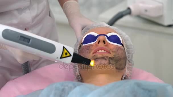 Procedimiento Descamación Facial Carbono Láser Pulsa Piel Limpia Cara Tratamiento — Vídeo de stock