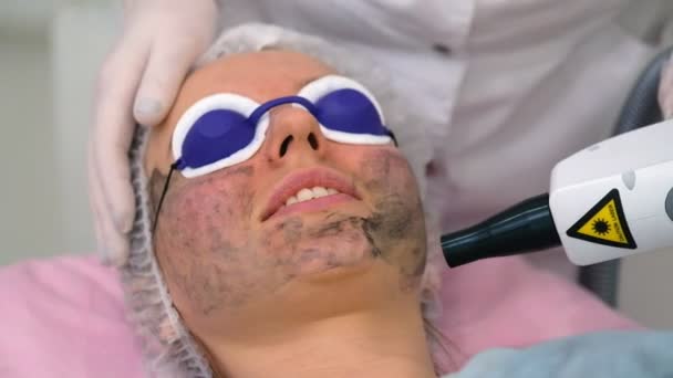 Procedura Peeling Viso Carbonio Laser Pulsa Pelle Pulita Del Viso — Video Stock